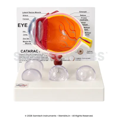 Human Eye Cataract Model manufacturer in India